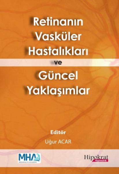 Retinanın Vasküler Hastalıkları ve Güncel Yaklaşımlar Uğur Acar